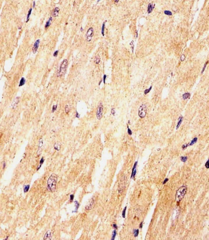 Rabbit Polyclonal Antibody to (Mouse) Med15