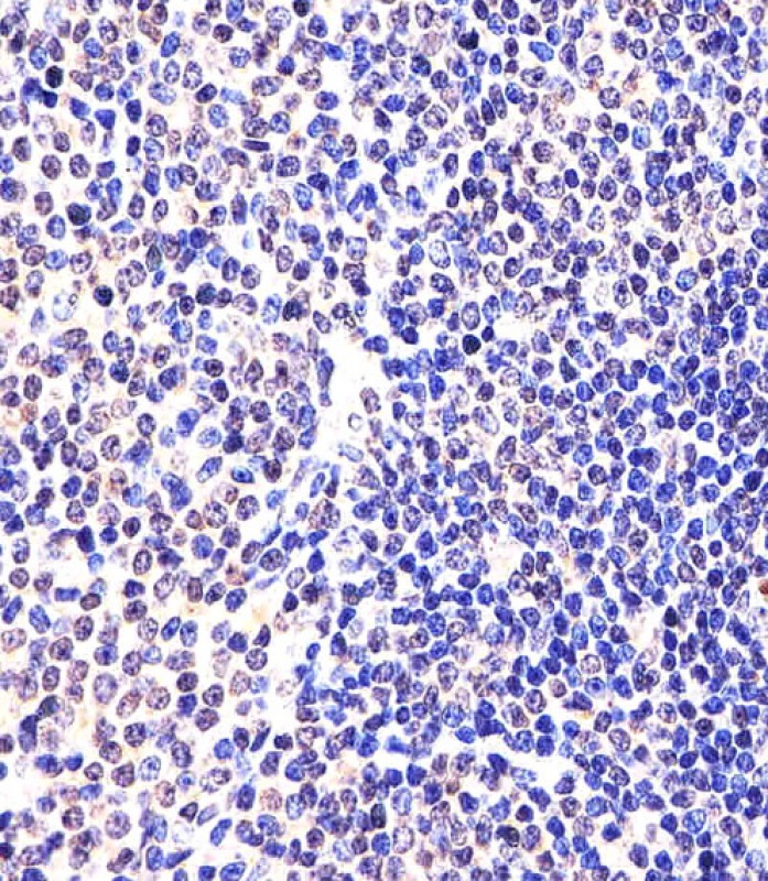 Rabbit Polyclonal Antibody to (Mouse) Eed