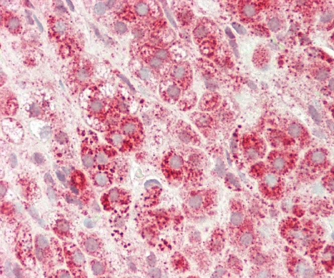 Rabbit Polyclonal Antibody to SLC16A11 (N-term)