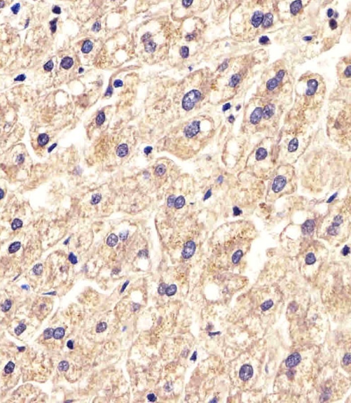 Rabbit Polyclonal Antibody to SLC16A11 (N-term)