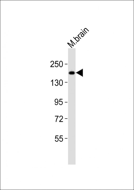 WHSC1L1 (N-term)