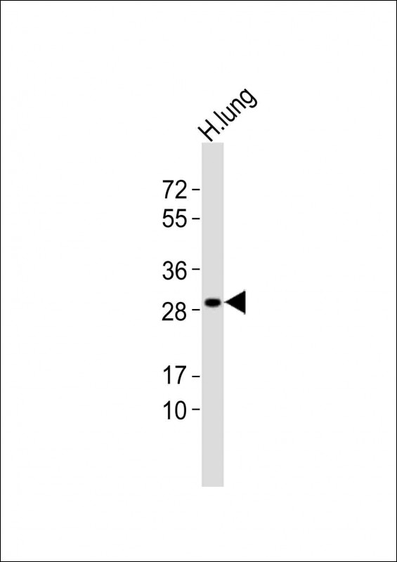 GSTT1 (N-term)