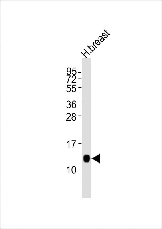 LALBA
