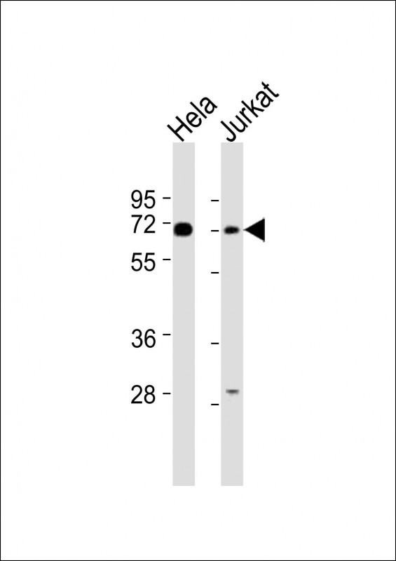 CBFA2T2 (N-term)