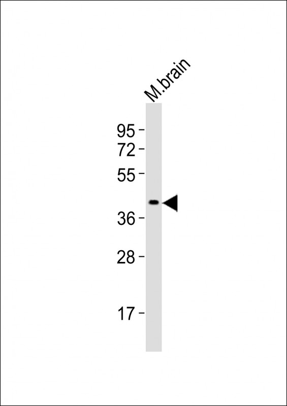 Mouse Rad9a (N-term)