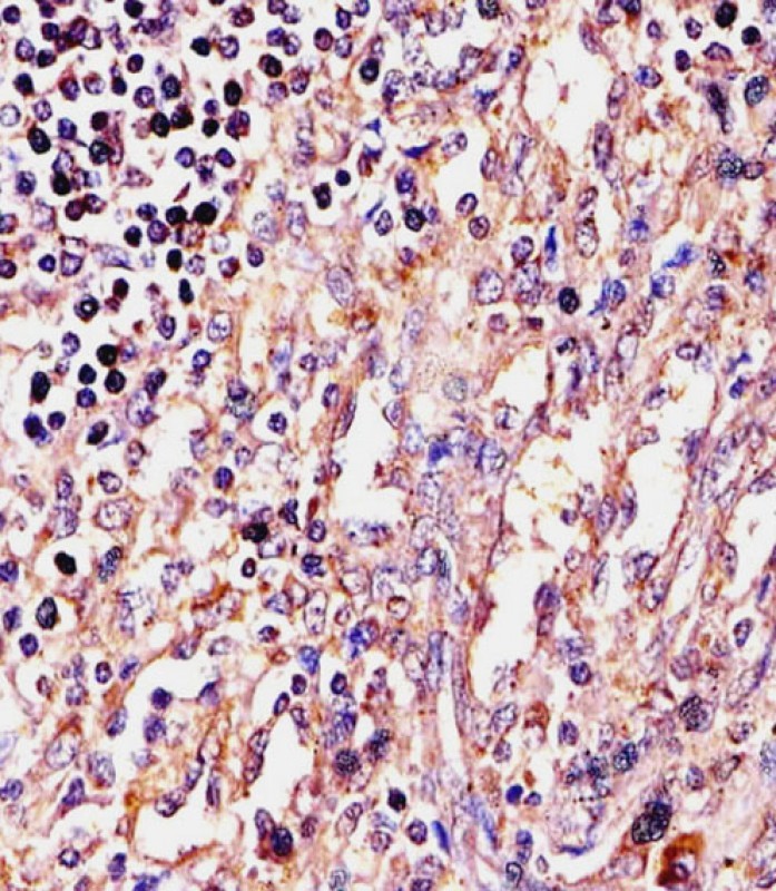 Rabbit Polyclonal Antibody to EXOC3