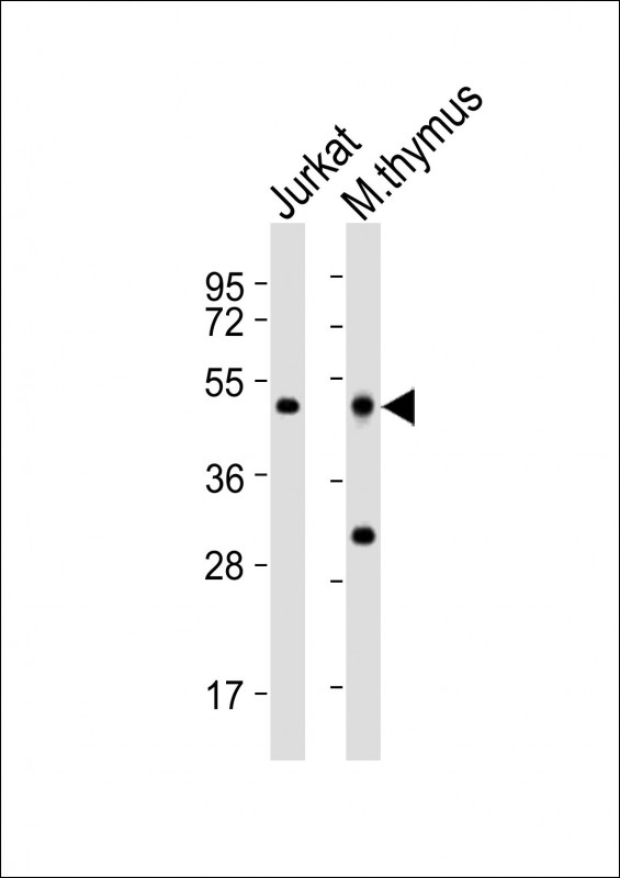 (Mouse) Dpf2 (N-term)