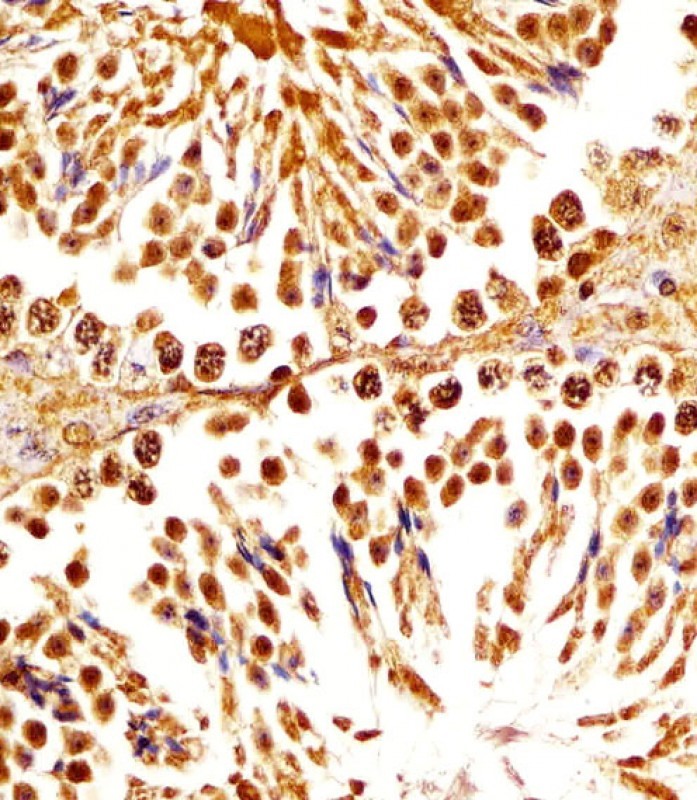 Rabbit Polyclonal Antibody to (Mouse) Dpf2 (N-term)