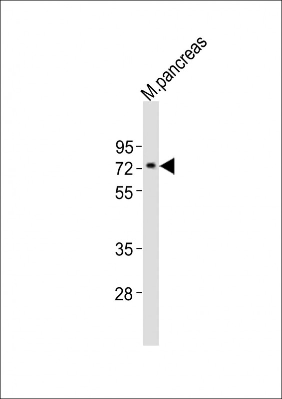 (Mouse) Nr4a2