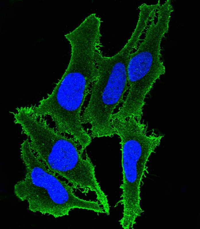 Rabbit Polyclonal Antibody to ATP2B3