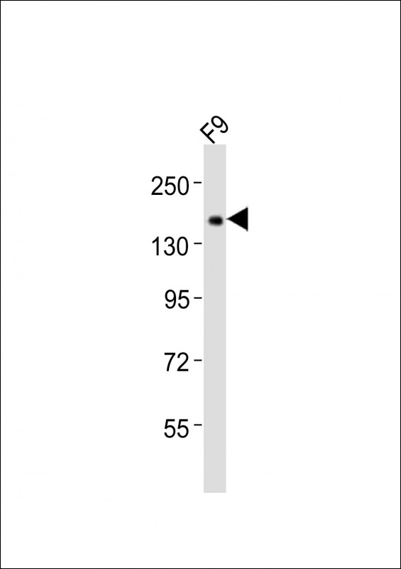 (Mouse) Tet1