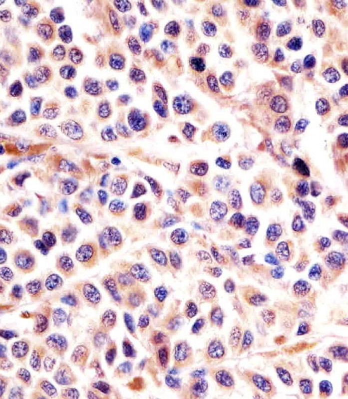 Rabbit Polyclonal Antibody to IL24