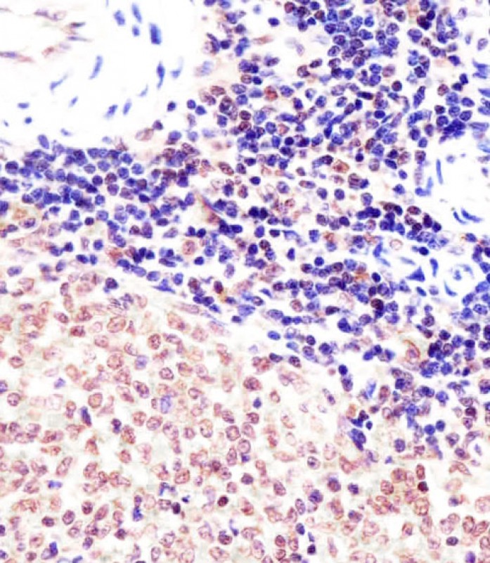 Rabbit Polyclonal Antibody to (Mouse) Suz12