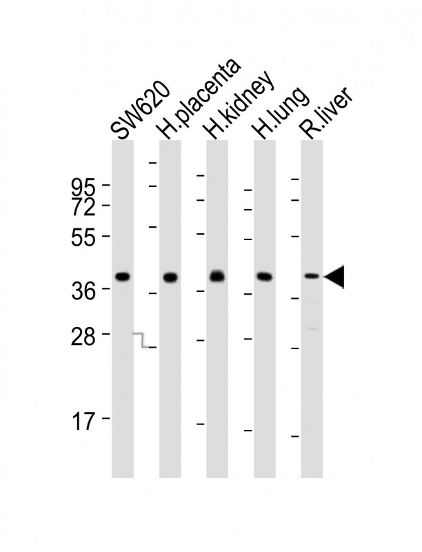 PPAP2B (N-term)