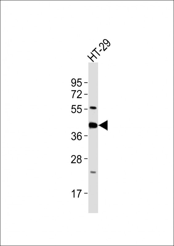 GNAI3