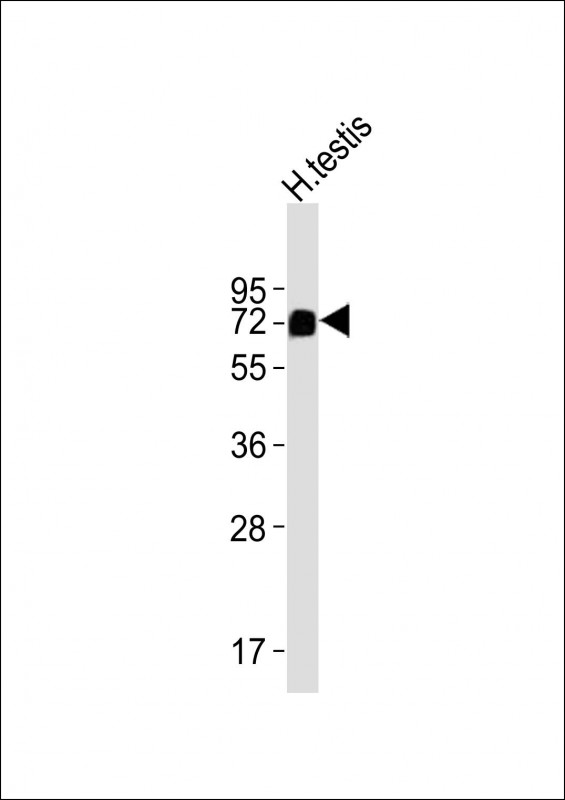 MFSD6L (N-term)
