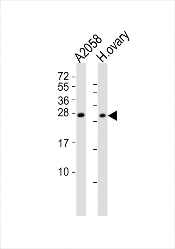 RHOXF1