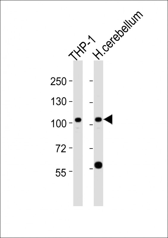 ZFPM1
