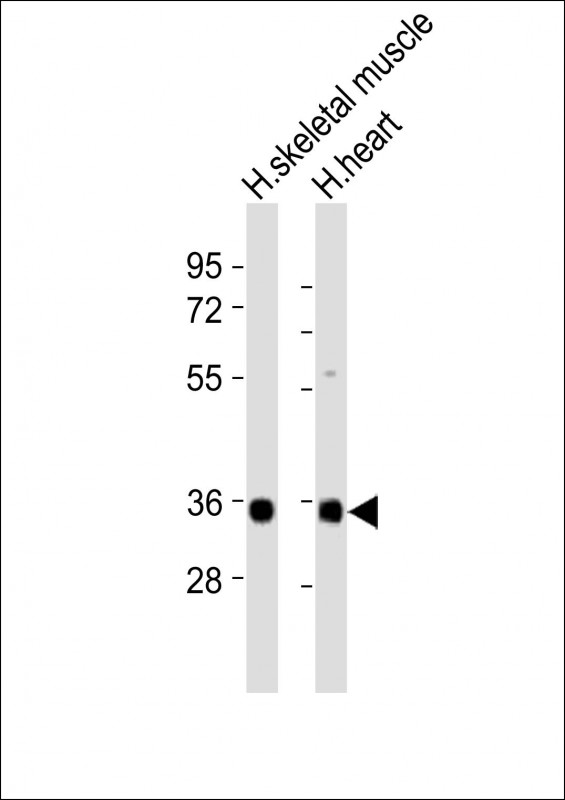 CLEC11A