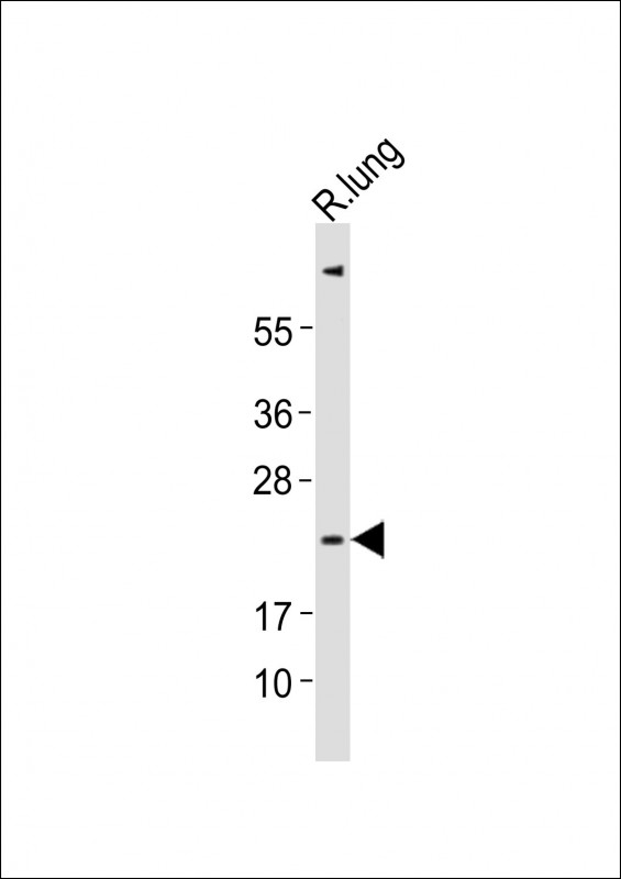 (Mouse) Ctf1