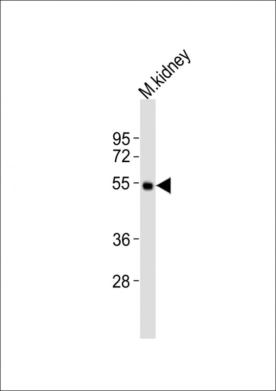 Drd5 (N-term).ctrl