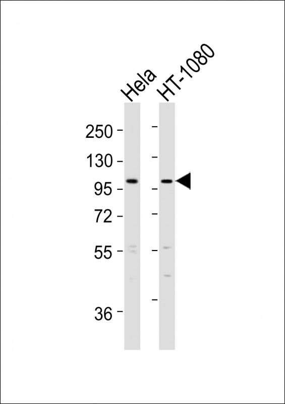 ADAMTS6 (N-Term)