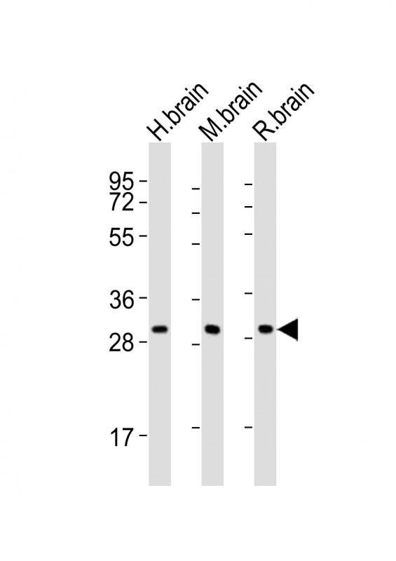 KCNMB2