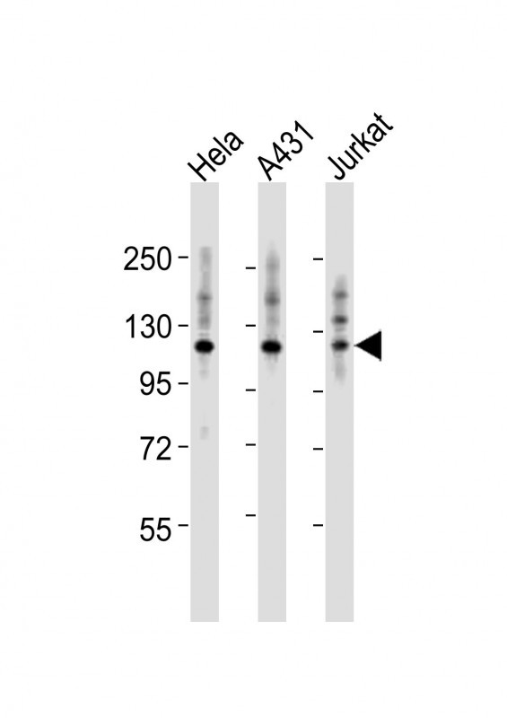 ITGA7 (N-term)