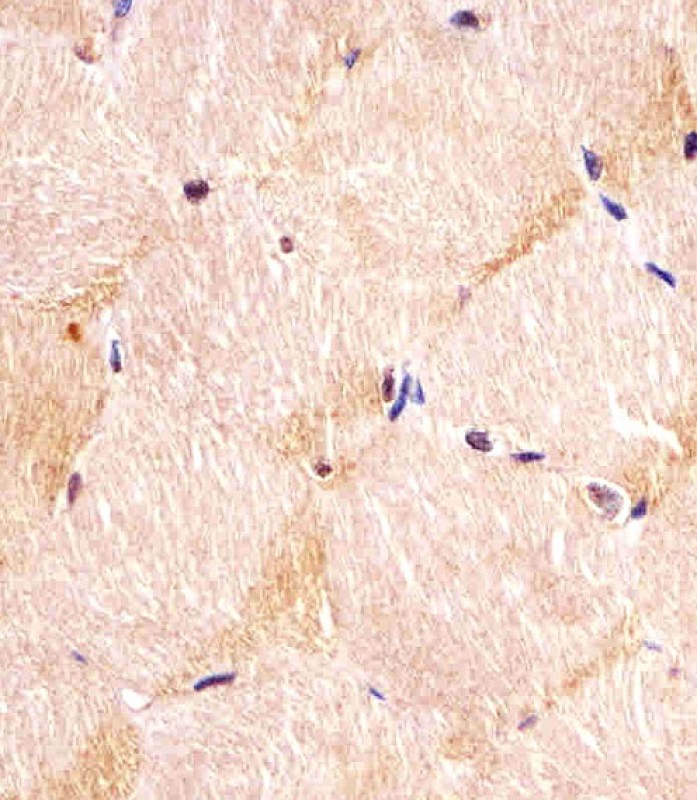 Rabbit Polyclonal Antibody to ITGA7 (N-term)