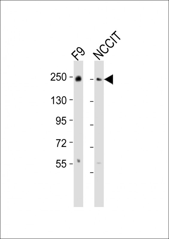 PBRM1