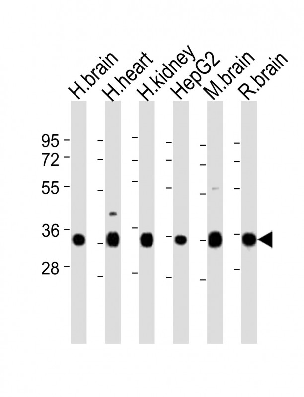 KCNMB2 (N-term)