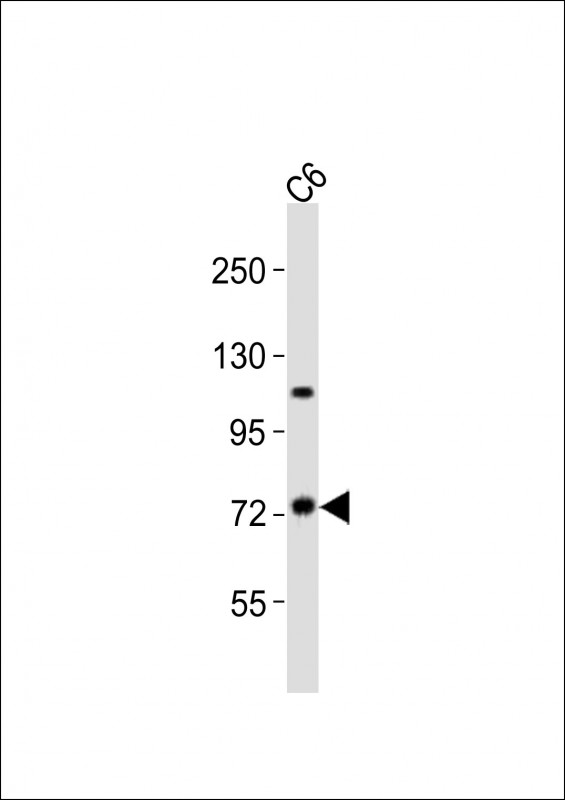 TAB2