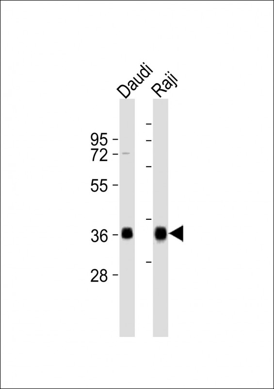 HLA-DQA1