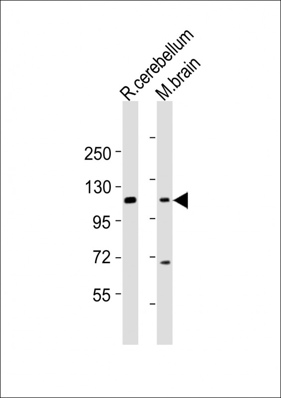 UNC5B