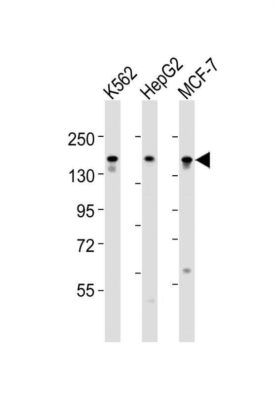 Rabbit Polyclonal Antibody to RAPGEF1