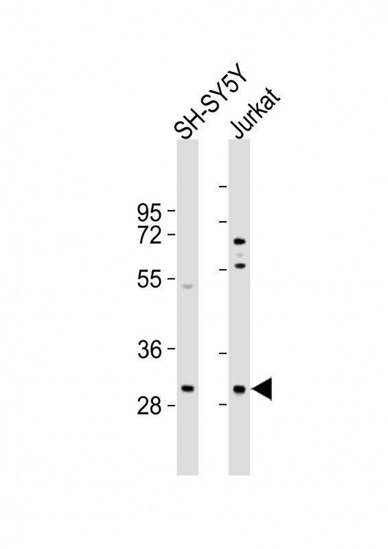 TRMT61A (N-term)