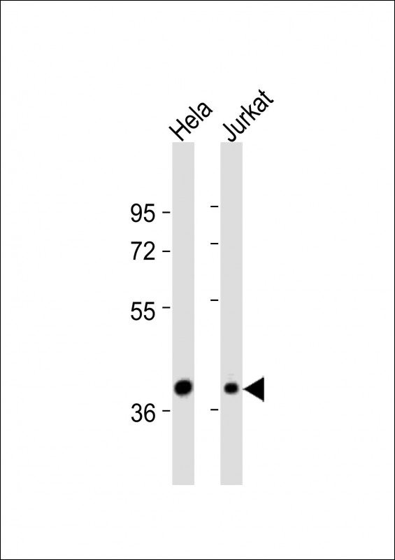 Rabbit Polyclonal Antibody to CREB3