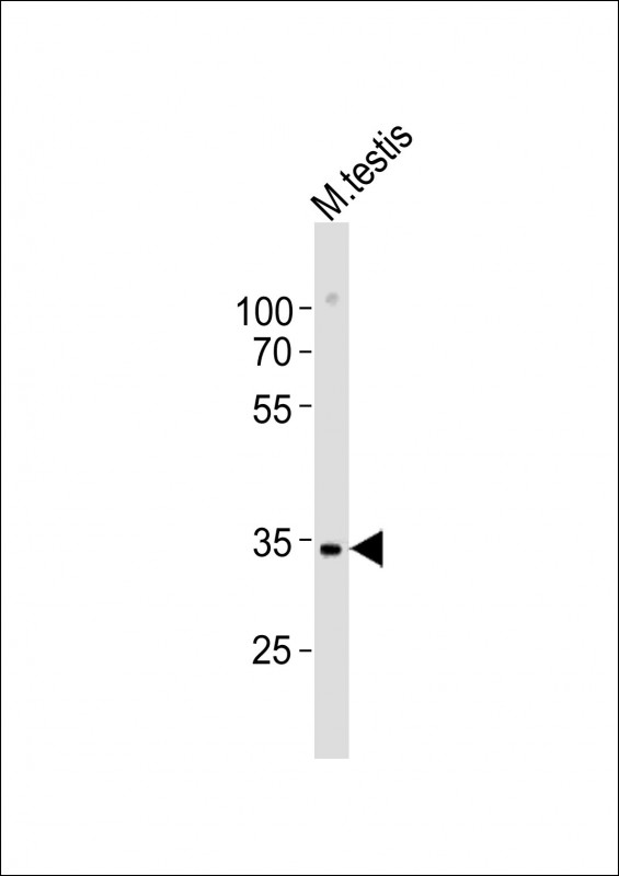 (Mouse) Mlf1