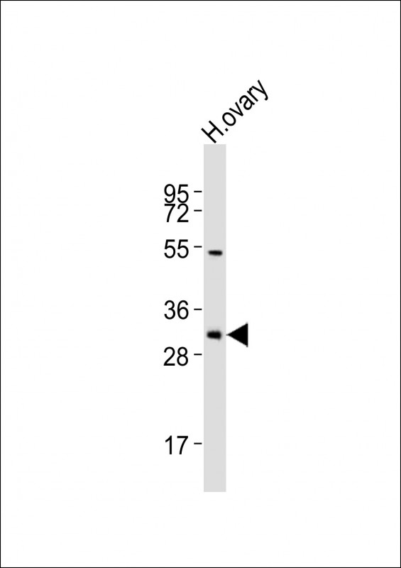 NBPF12