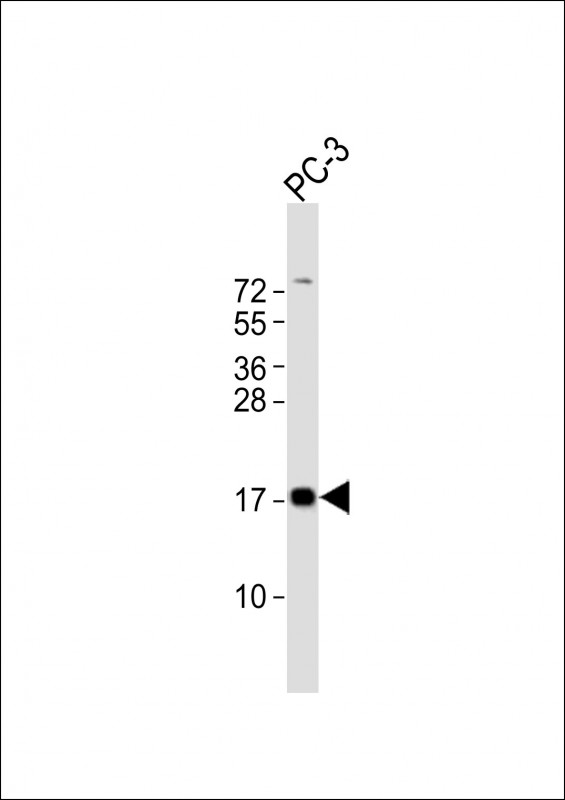 PLP2