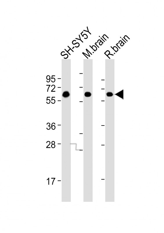 DPYSL5