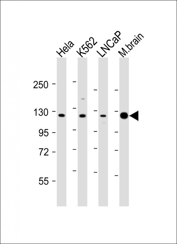 JMJD2C