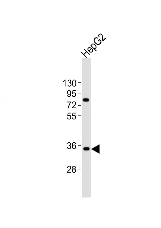 AKR7L (N-Term)