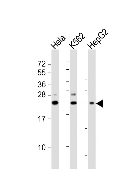 SRY (N-Term)