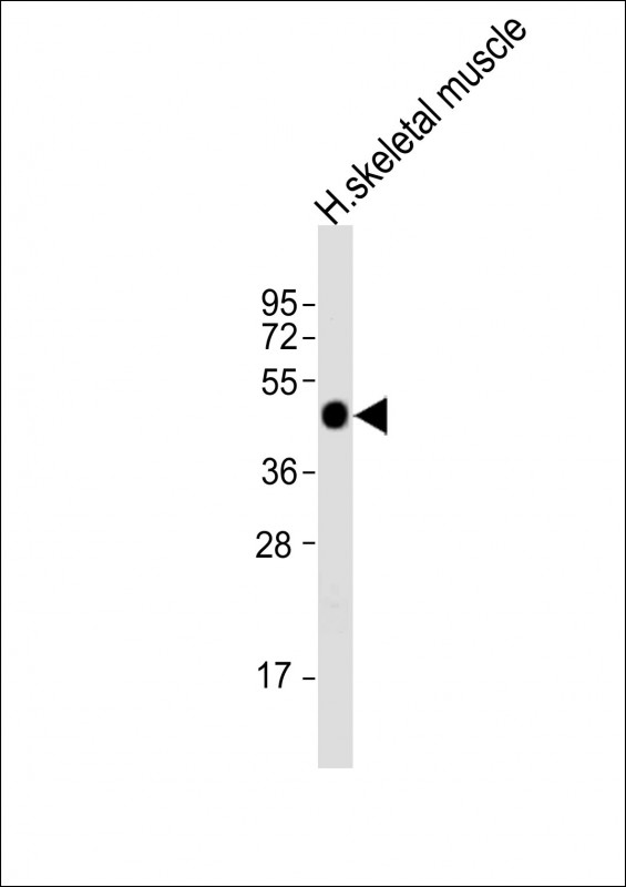 AGPHD1 (N-Term)