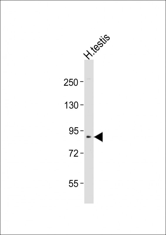 RAD54B (N-term)