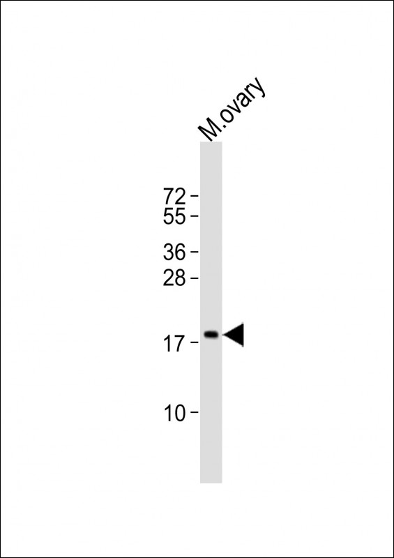 NDUFB7 (N-term)