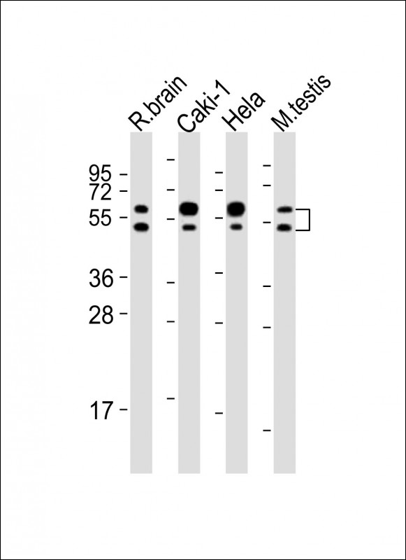 CDKL3 (N-Term)
