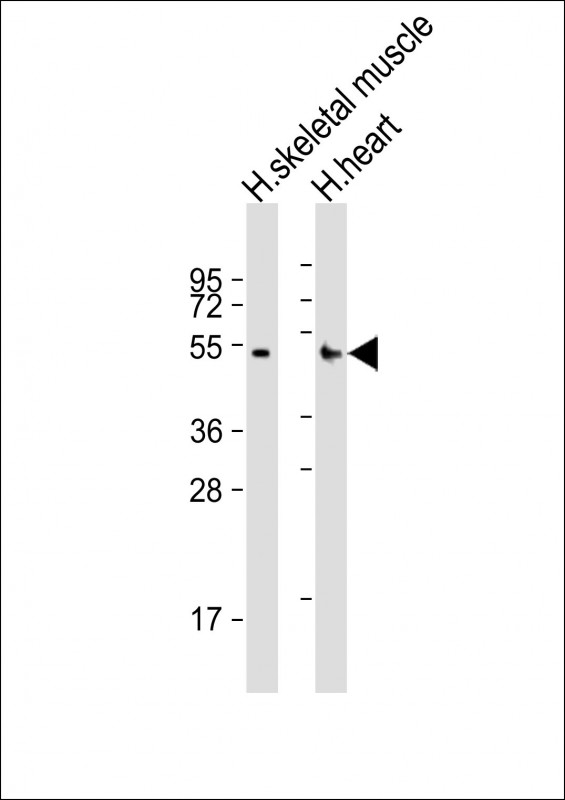 RHBDL1
