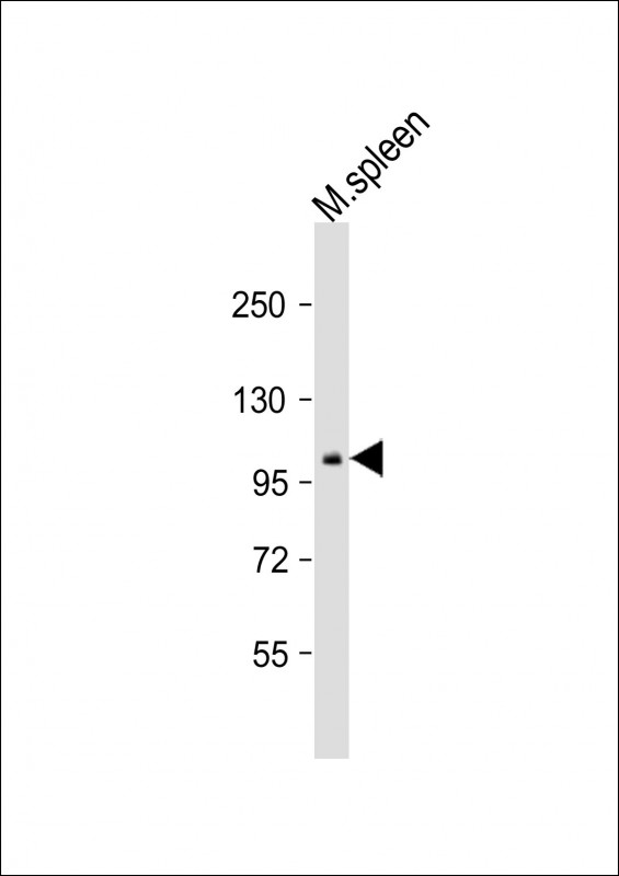 Mouse Ptk2b (P851)